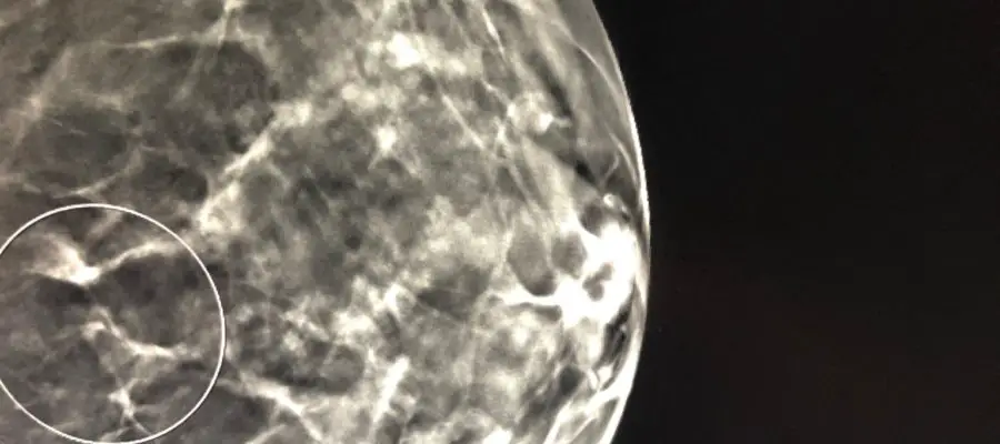 diagnostic breast imaging