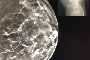 breast imaging versus MSK