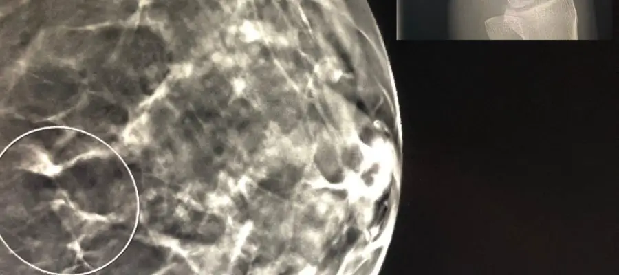 breast imaging versus MSK