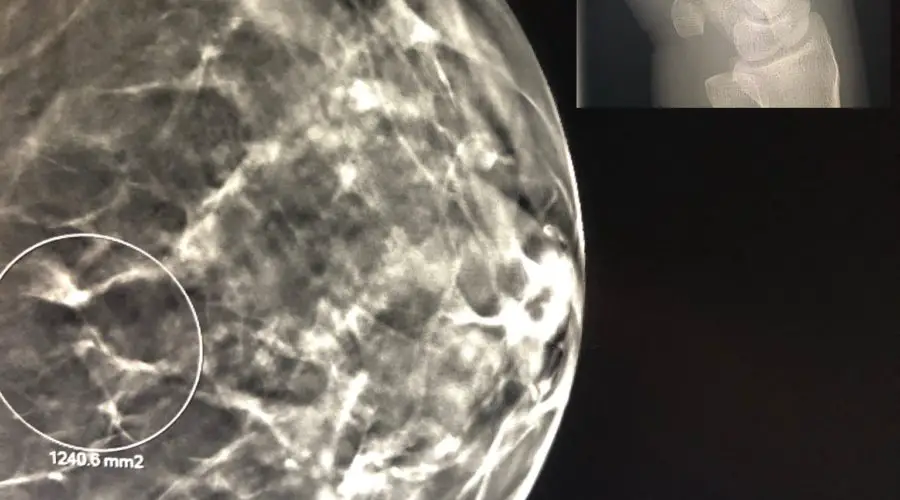 breast imaging versus MSK